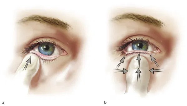 eyelid-malposition-treatment